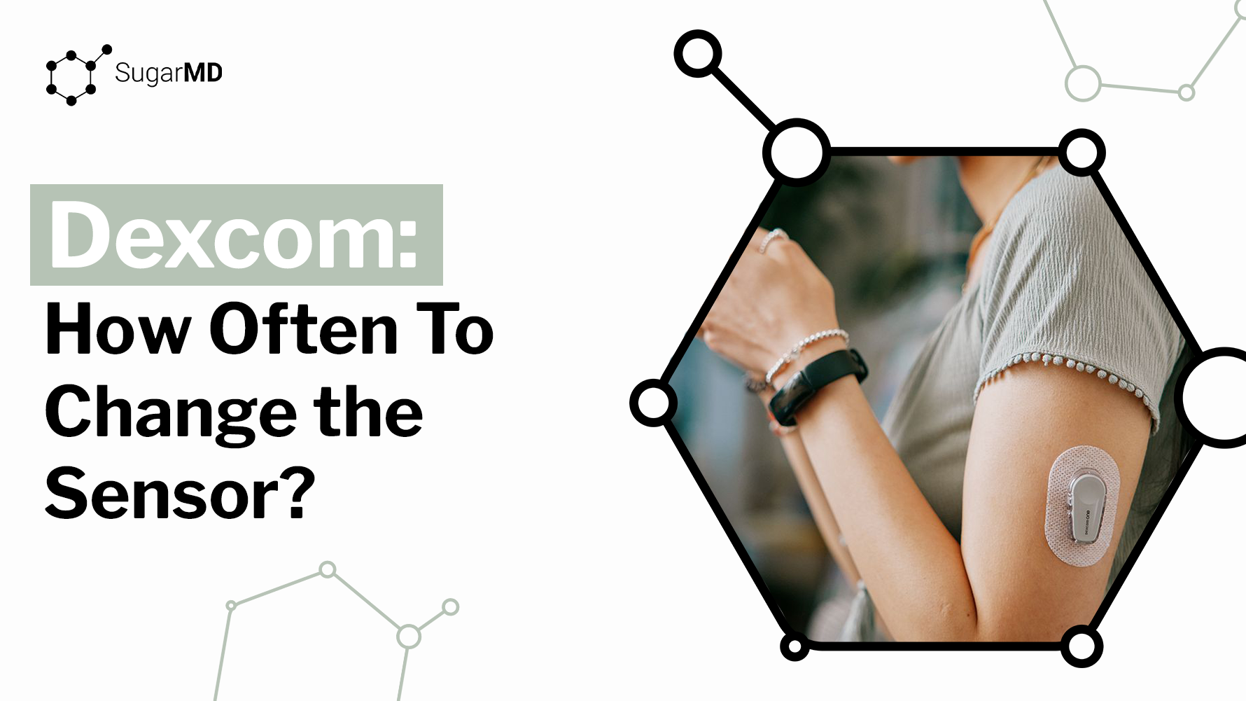 Person wearing a Dexcom sensor on the upper arm next to the text “Dexcom: How Often To Change the Sensor?”